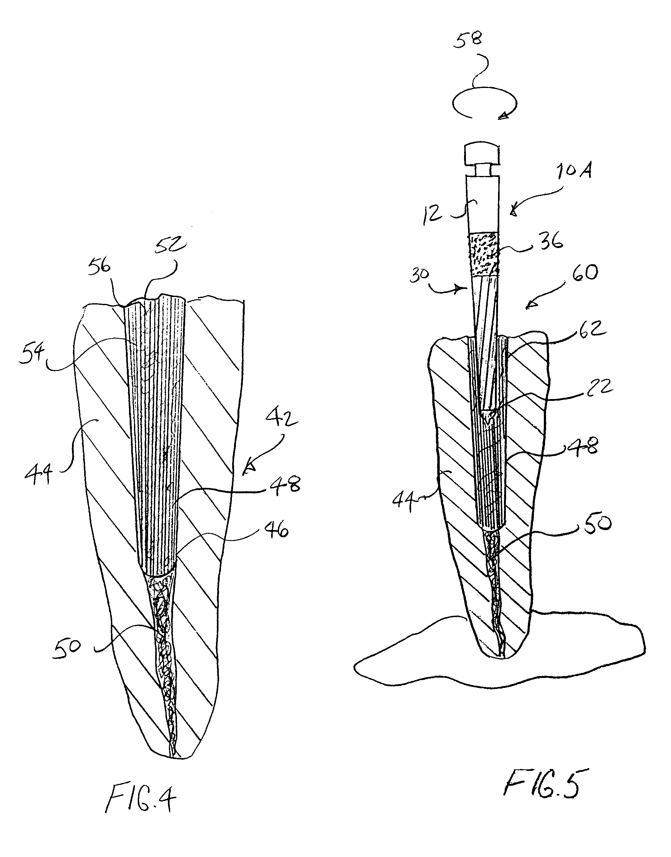 Dental bur