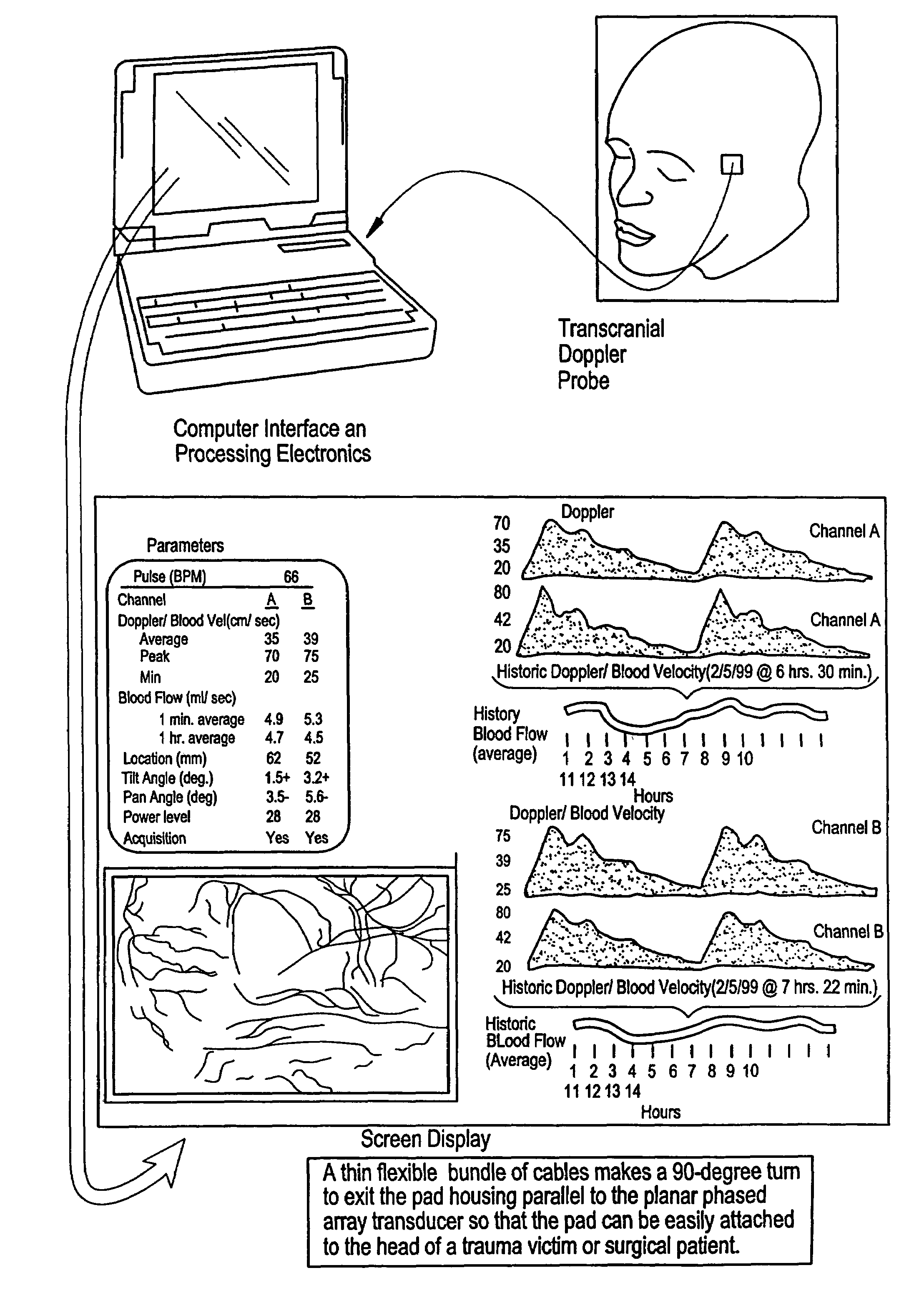 Transmitter patterns for multi beam reception