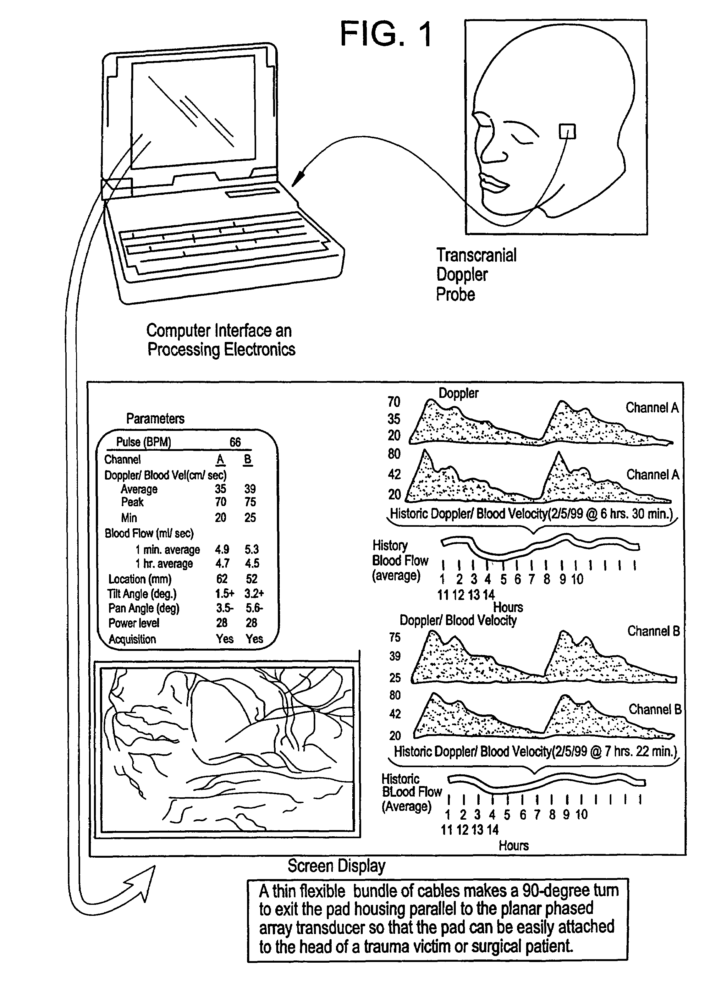 Transmitter patterns for multi beam reception