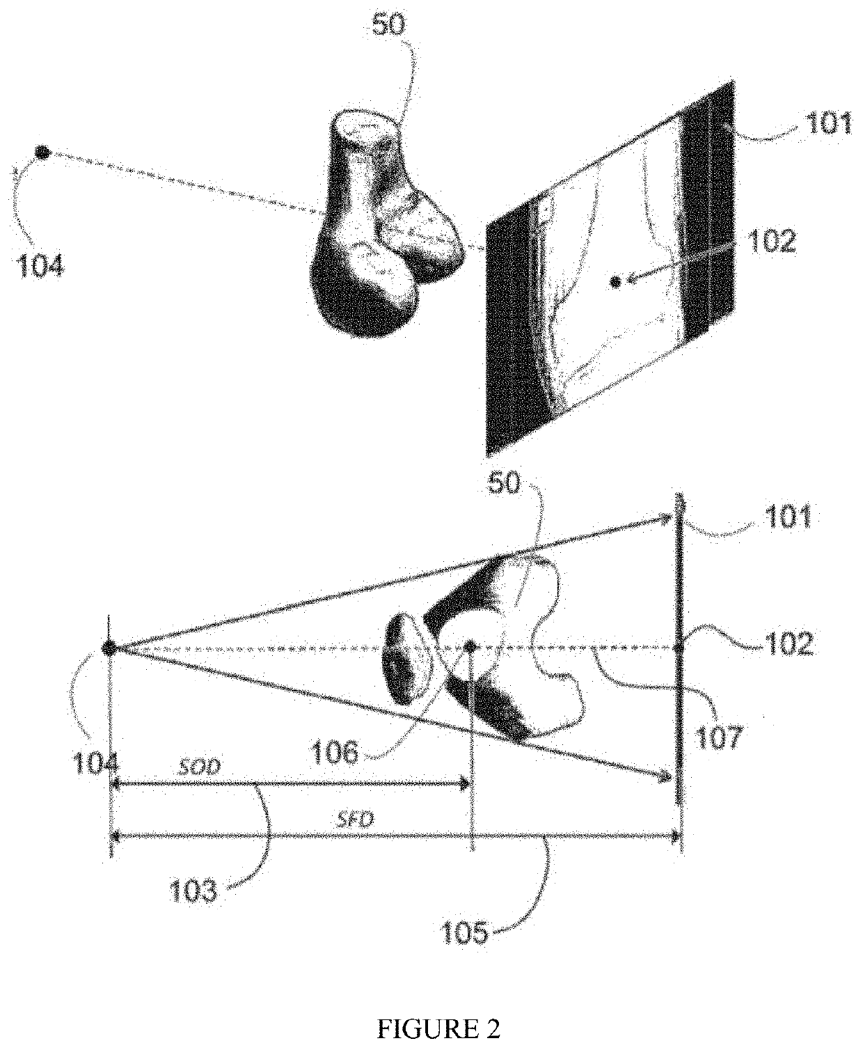 A method for obtaining 3-d deformity correction for bones