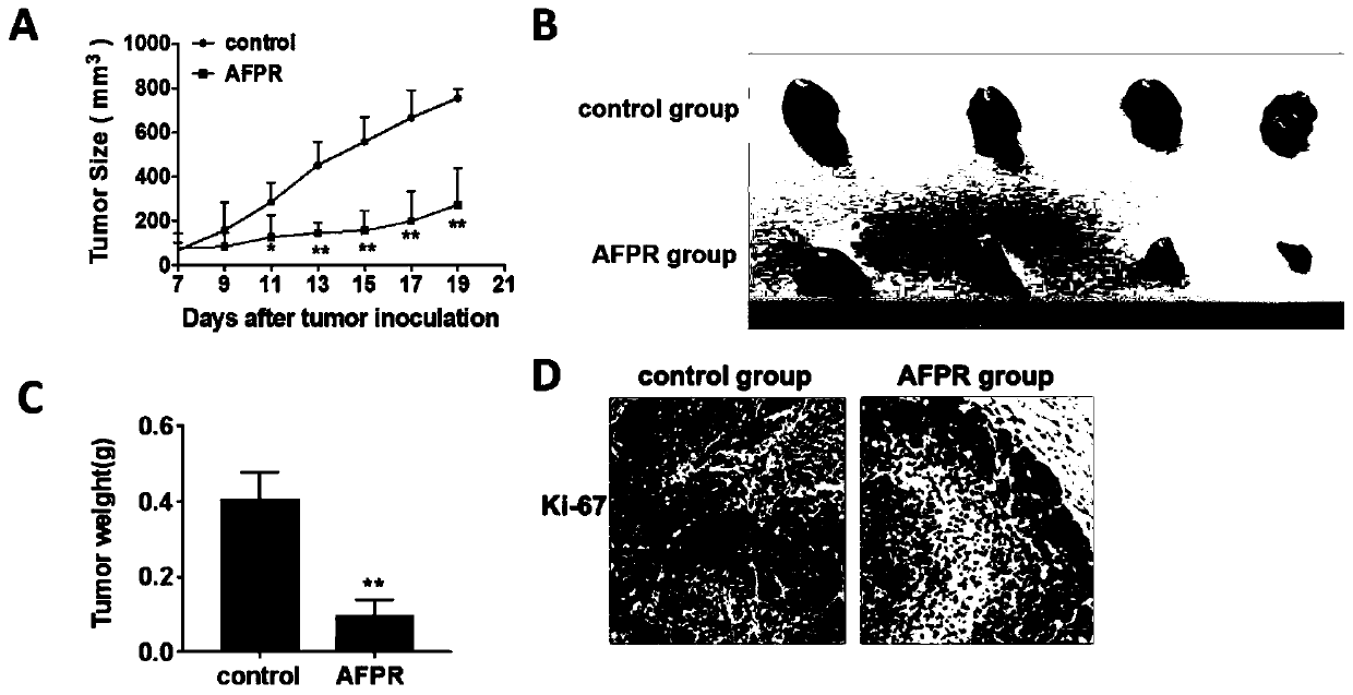 Application of polyrhachis vicina extract in preparation of medicines for preventing and treating breast cancer and related diseases