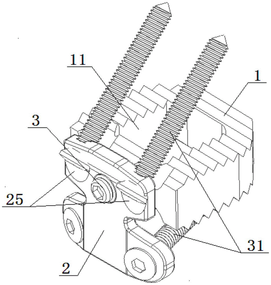 Adaptive floating combined cervical interbody cage