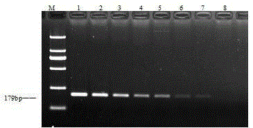 Mycoplasma hyopneumoniae loop-mediated isothermal amplification kit and application thereof