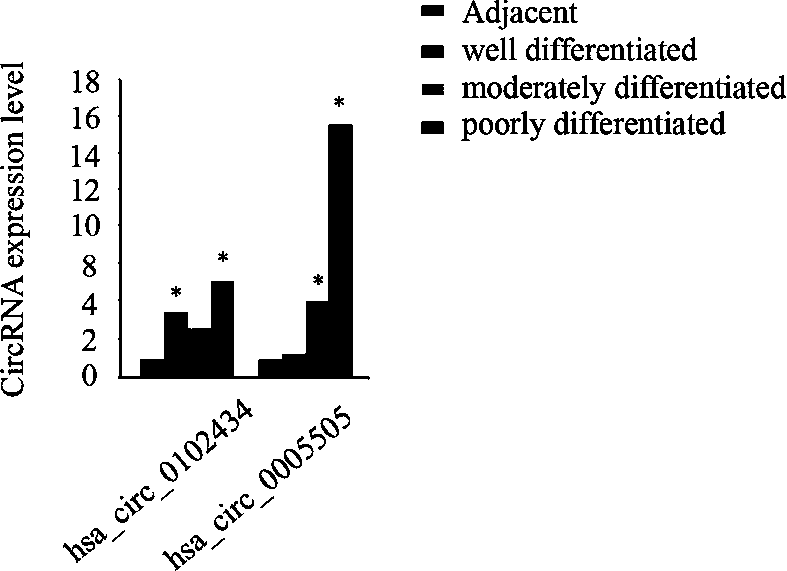 CircRNA markers for diagnosing poorly differentiated adenocarcinoma of stomach and application thereof