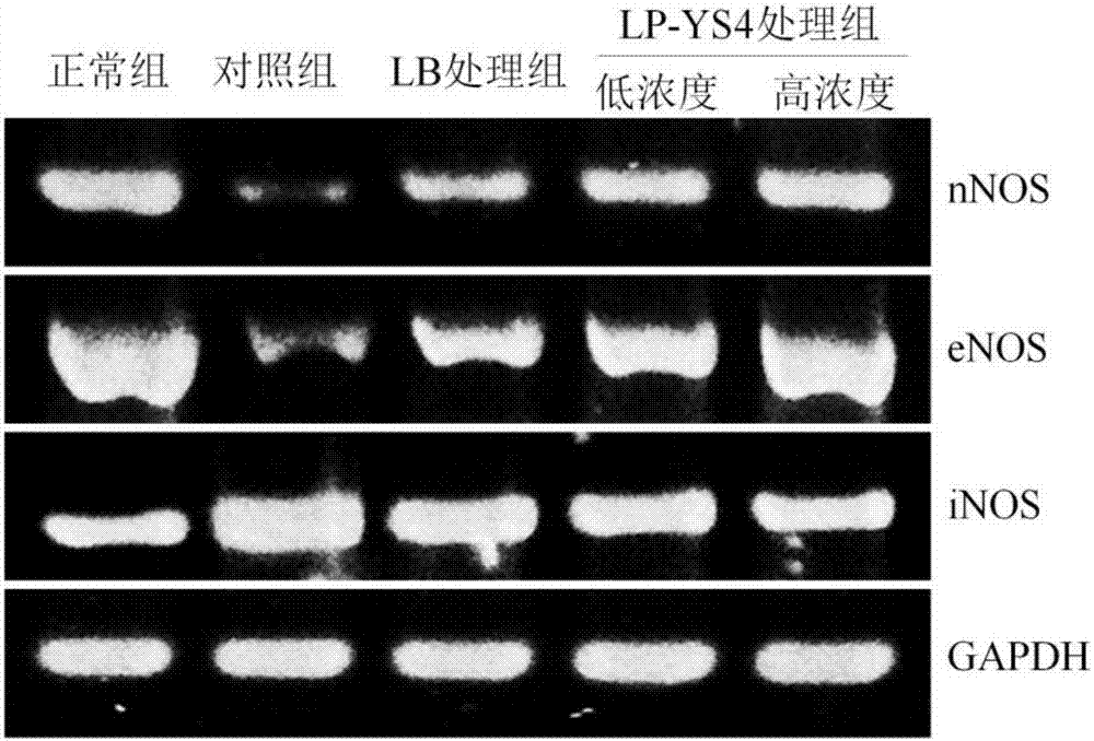 Application of lactobacillus plantarum YS4 in preparation of food or drugs for preventing ulcerative colitis