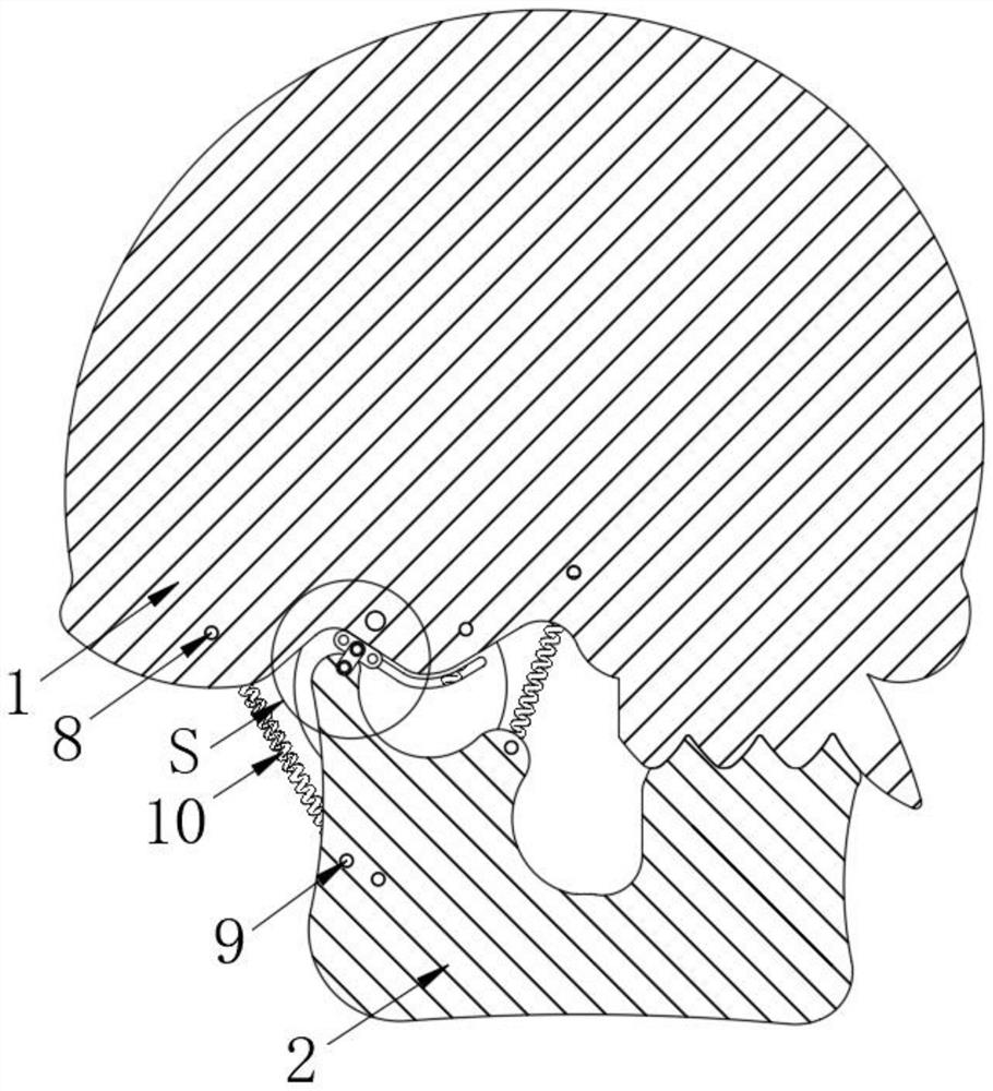 Three-dimensional skull model with temporomandibular joint disc