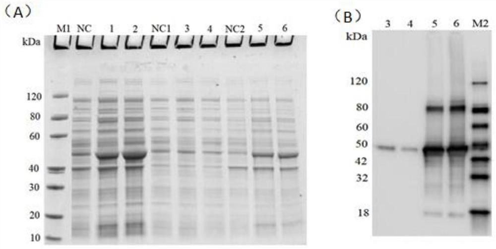 Beta-glucan synthase activity detection kit, detection method and application