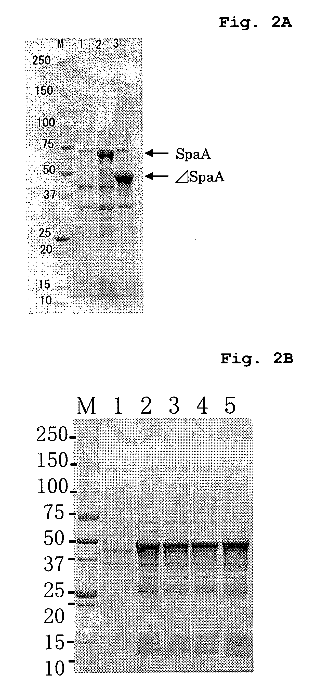 Process for Preparing Variant of Erysipelothrix Rhusiopathiae Surface Protective Antigen in E. Coli