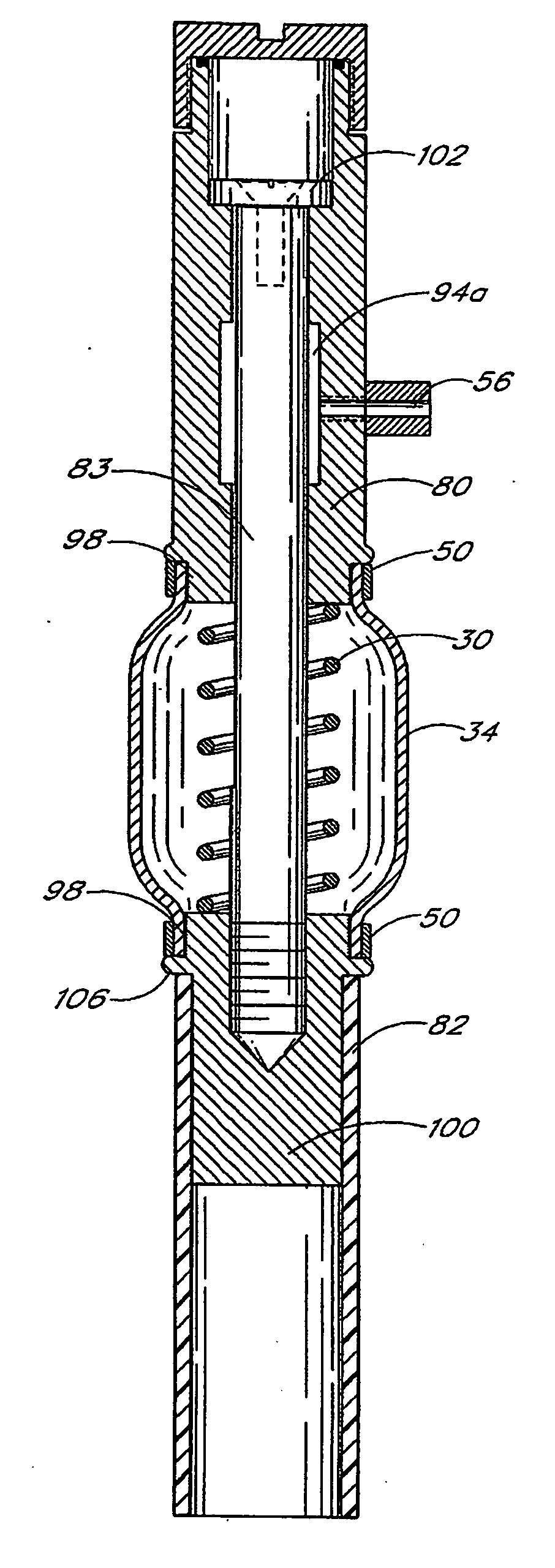 Active shock module prosthesis