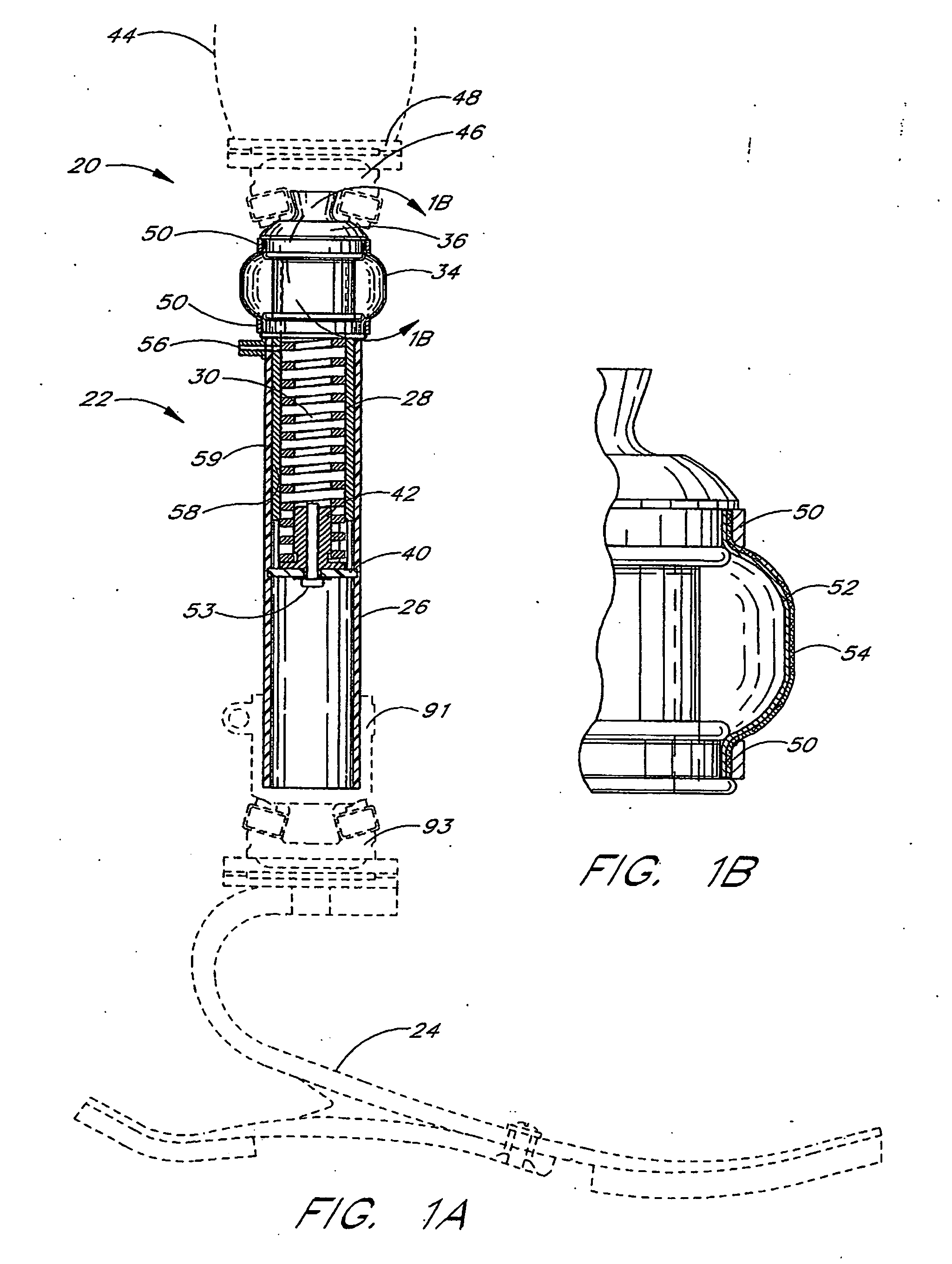 Active shock module prosthesis