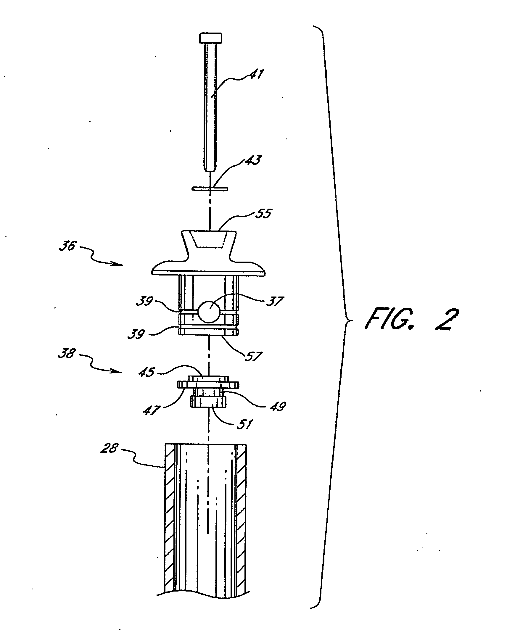 Active shock module prosthesis