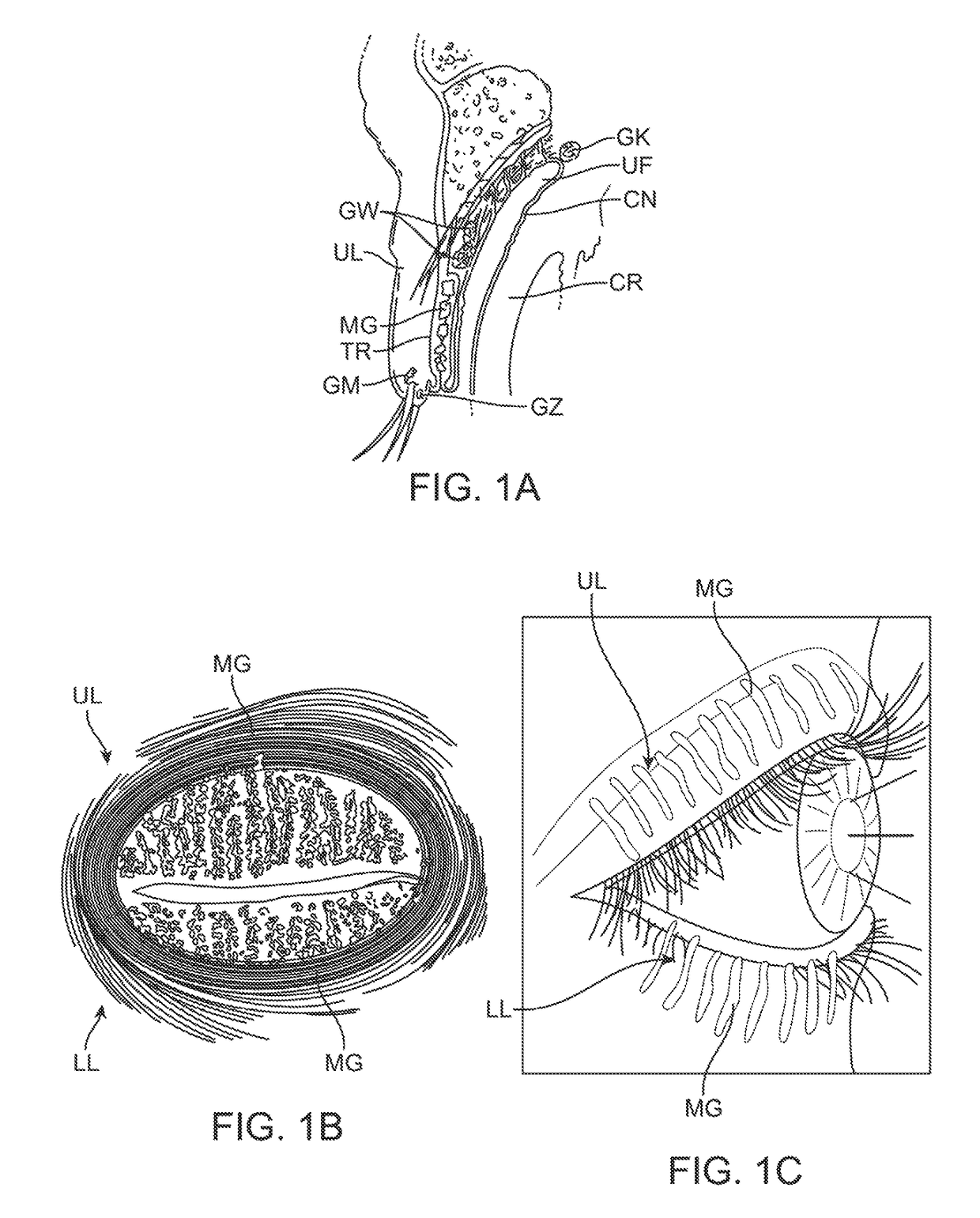 Dry eye treatment apparatus and methods