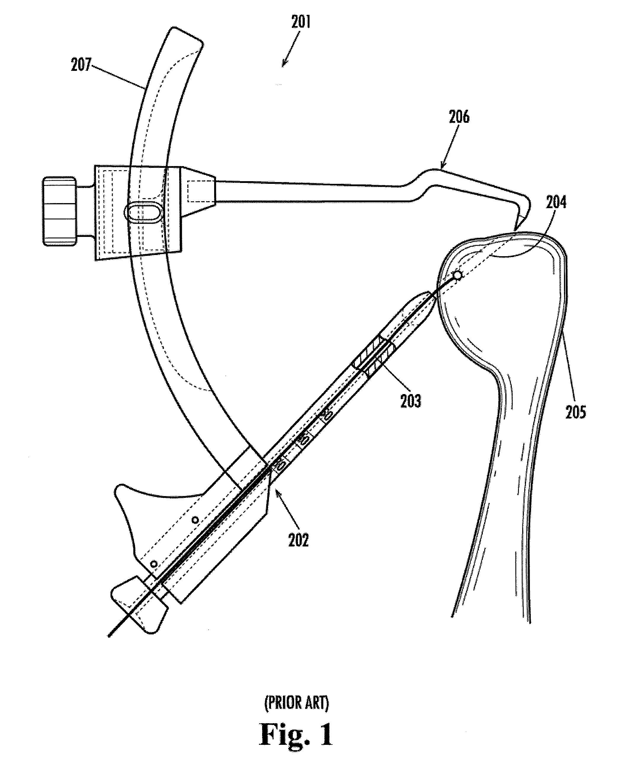 Method for drilling angled osteal tunnels