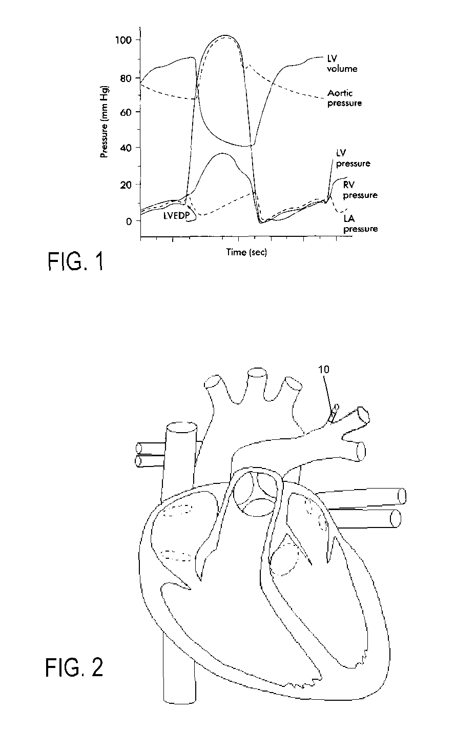 Delivery method and system for monitoring cardiovascular pressures