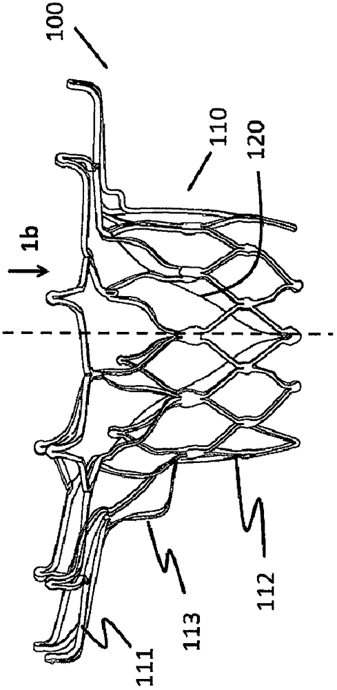 Heart valve prosthesis