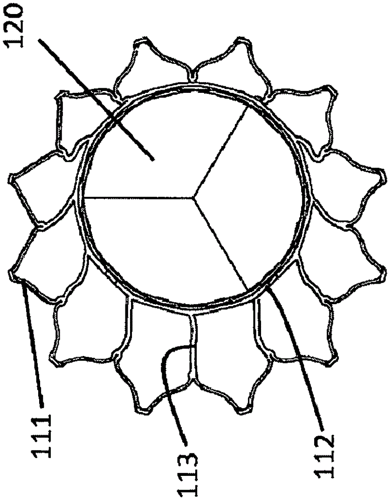 Heart valve prosthesis