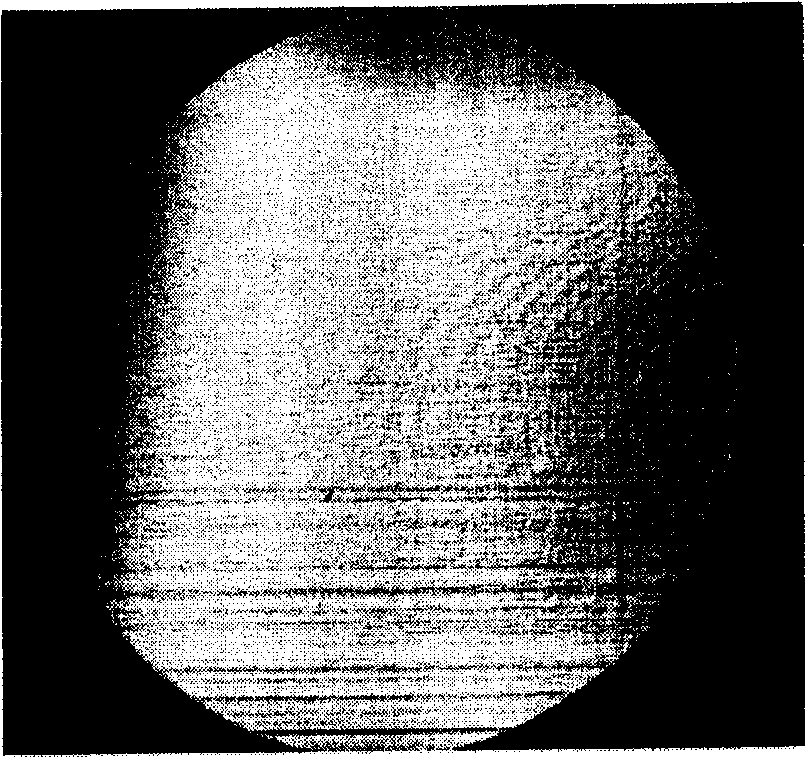 Human eyes high order optical aberration orthopraxy method