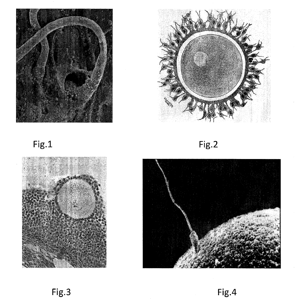 Compressed capsules for giving birth to males