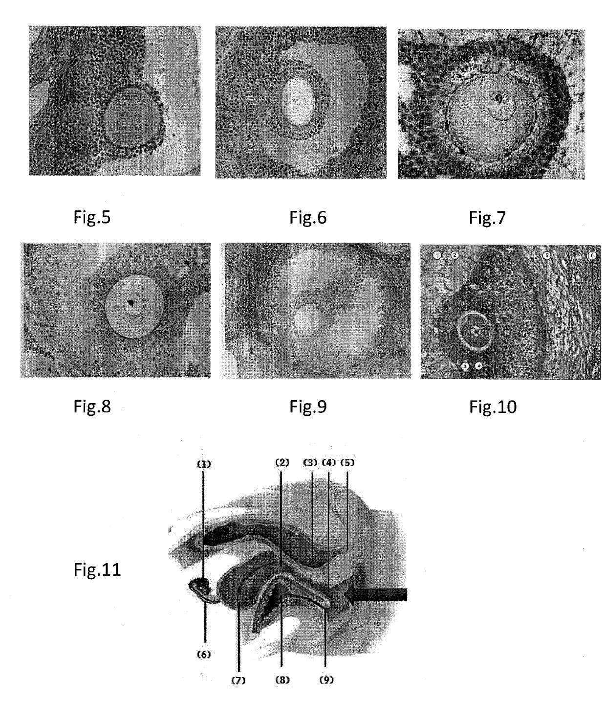 Compressed capsules for giving birth to males