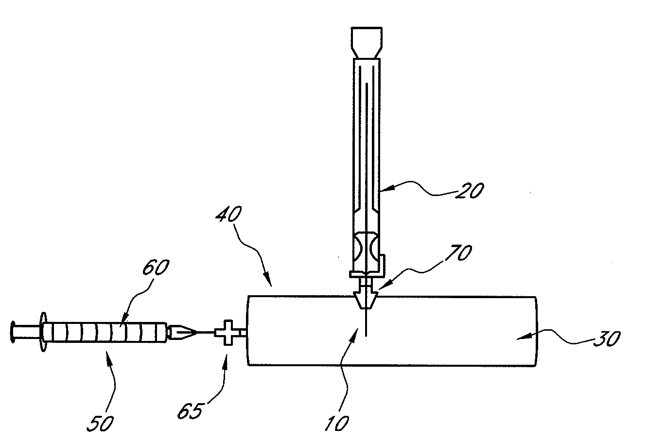 Device and methods for calibrating analyte sensors