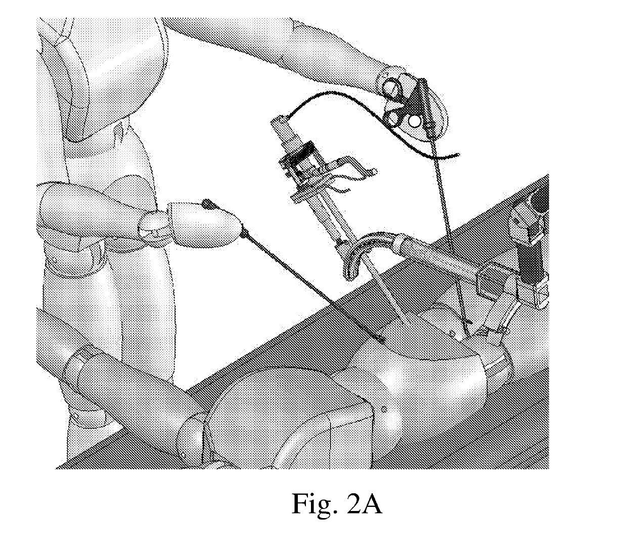 Device and method for assisting laparoscopic surgery - rule based approach