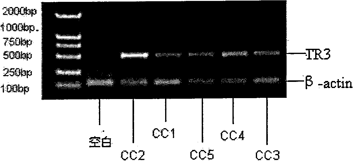 Composition and application thereof as TR3 receptor inducer