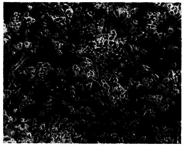 Adult nephroblastoma HANB cell strain and culturing method and application thereof