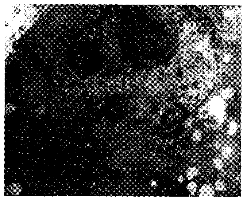 Adult nephroblastoma HANB cell strain and culturing method and application thereof