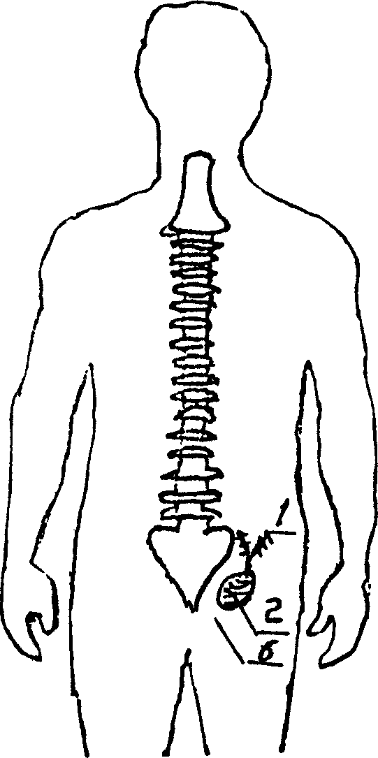 Biological affinitic electrode stimulating device