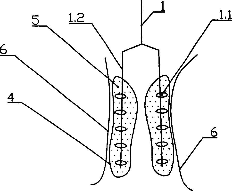 Biological affinitic electrode stimulating device