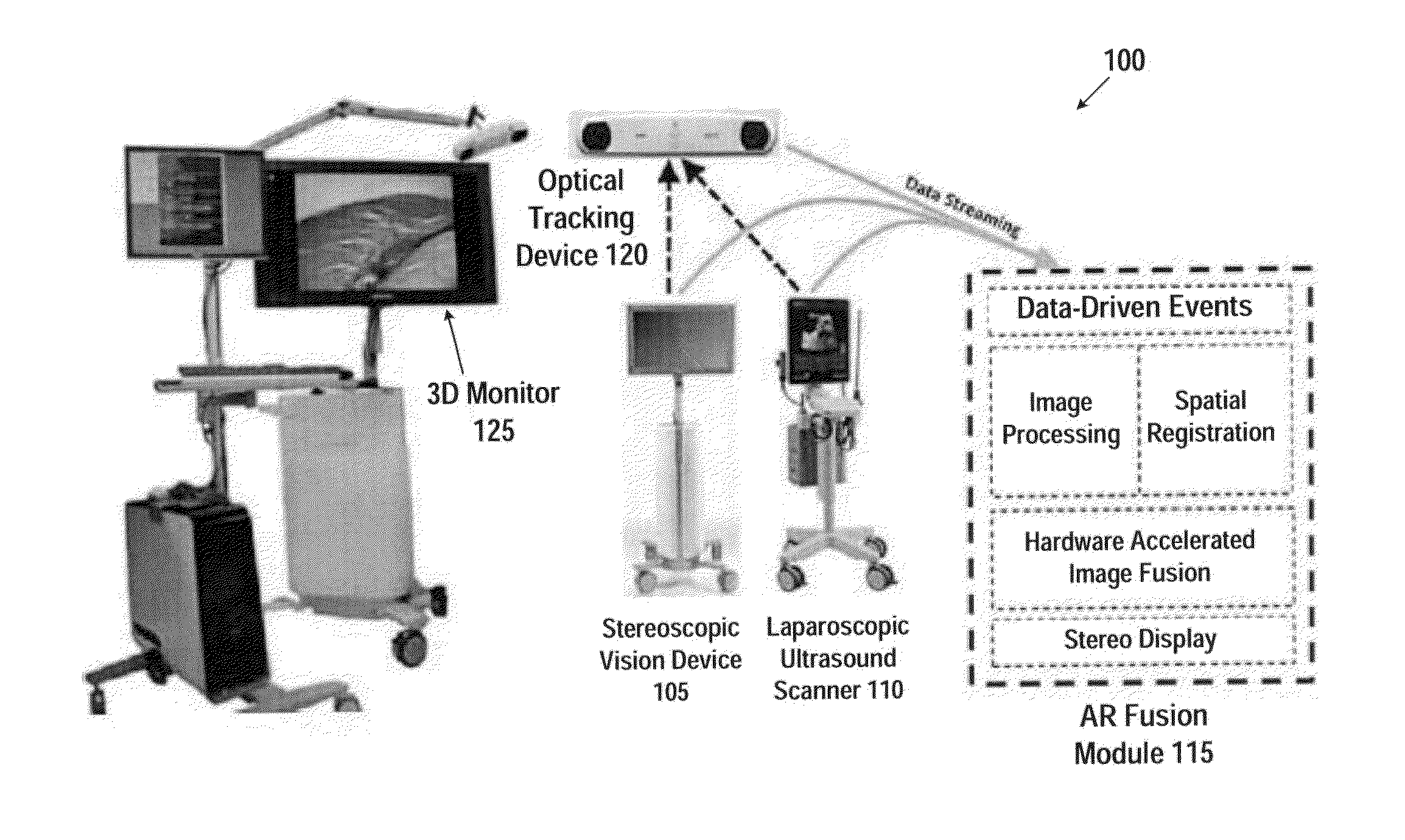 Device and method for generating composite images for endoscopic surgery of moving and deformable anatomy