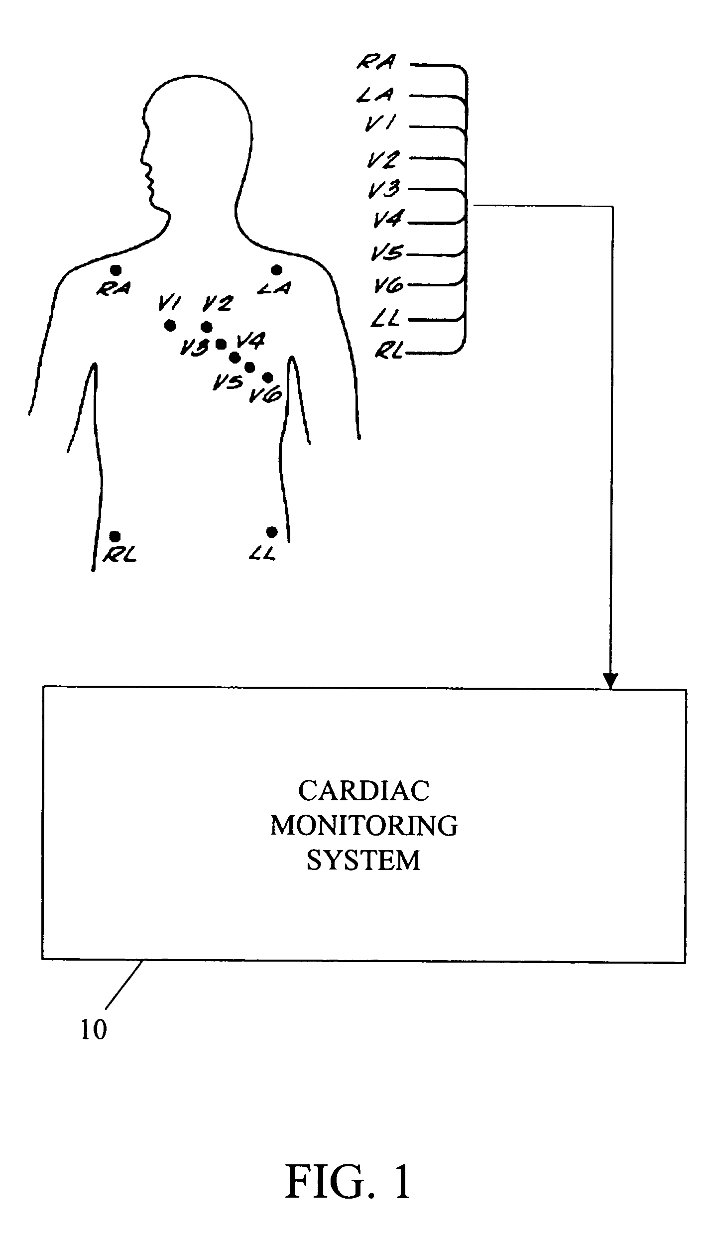 Method and apparatus for determining alternans data of an ECG signal