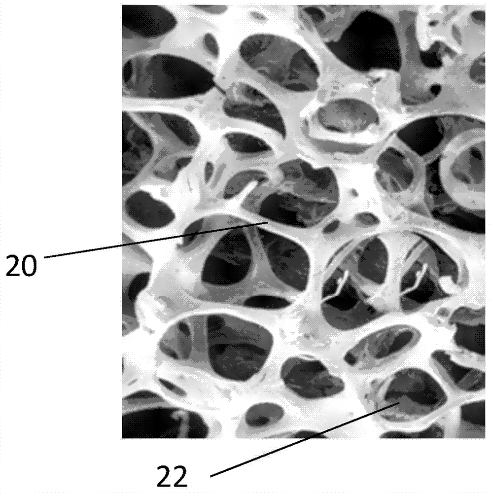 Artificial hip joint