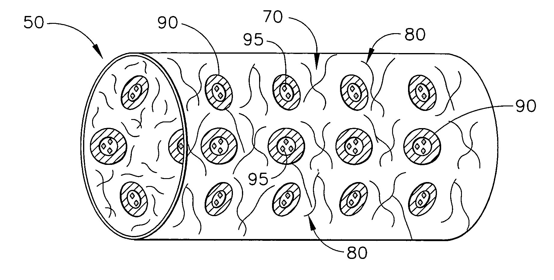 Biodegradable medical implant with encapsulated buffering agent