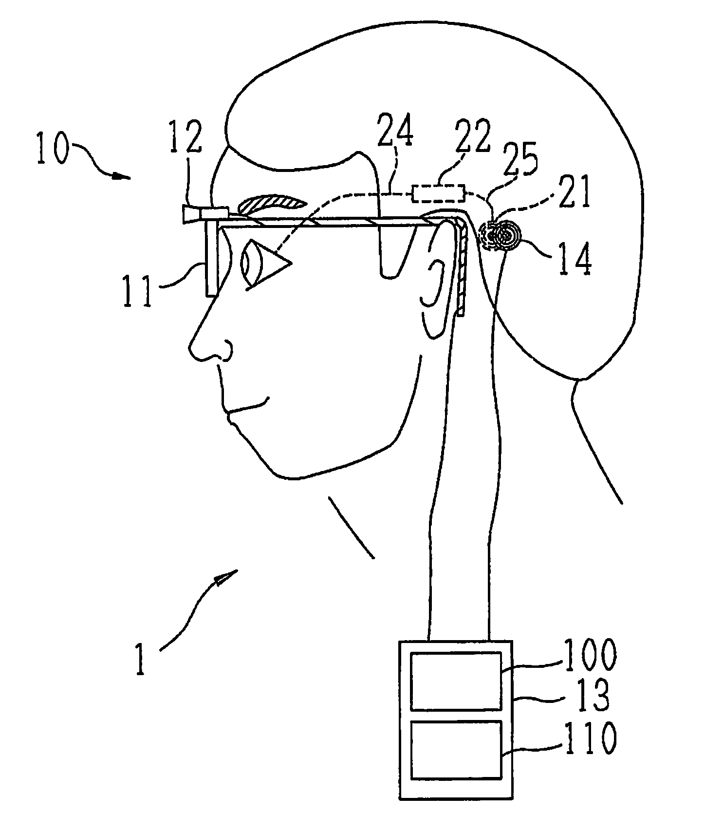 Vision regeneration assisting device