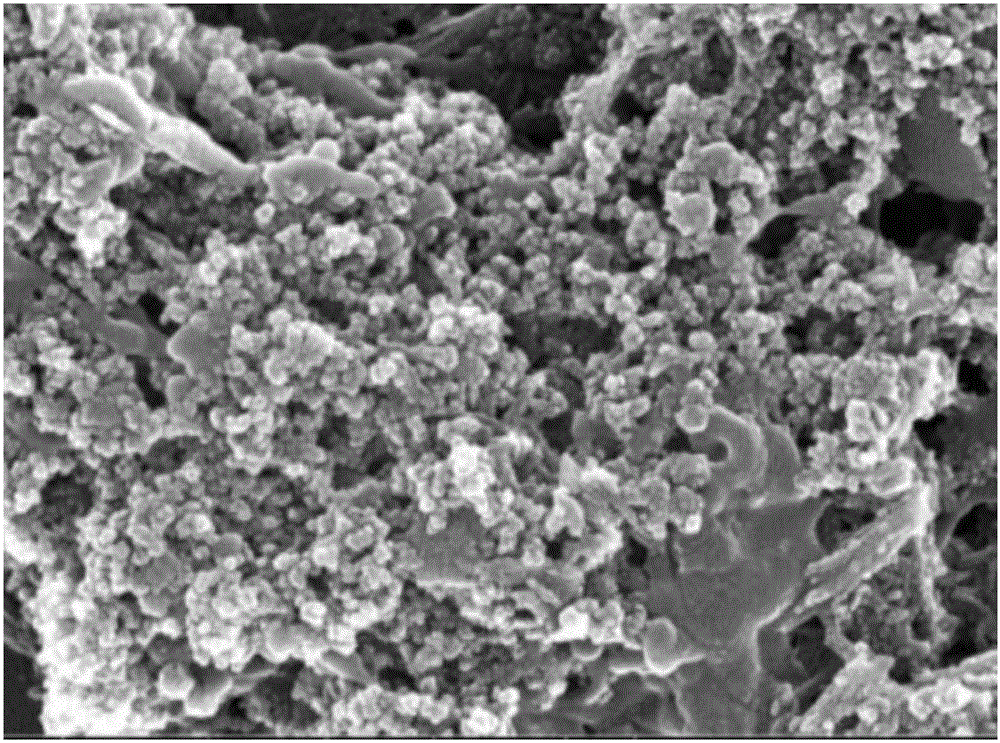 Purpose of umbilical cord mesenchymal stem cell exosome