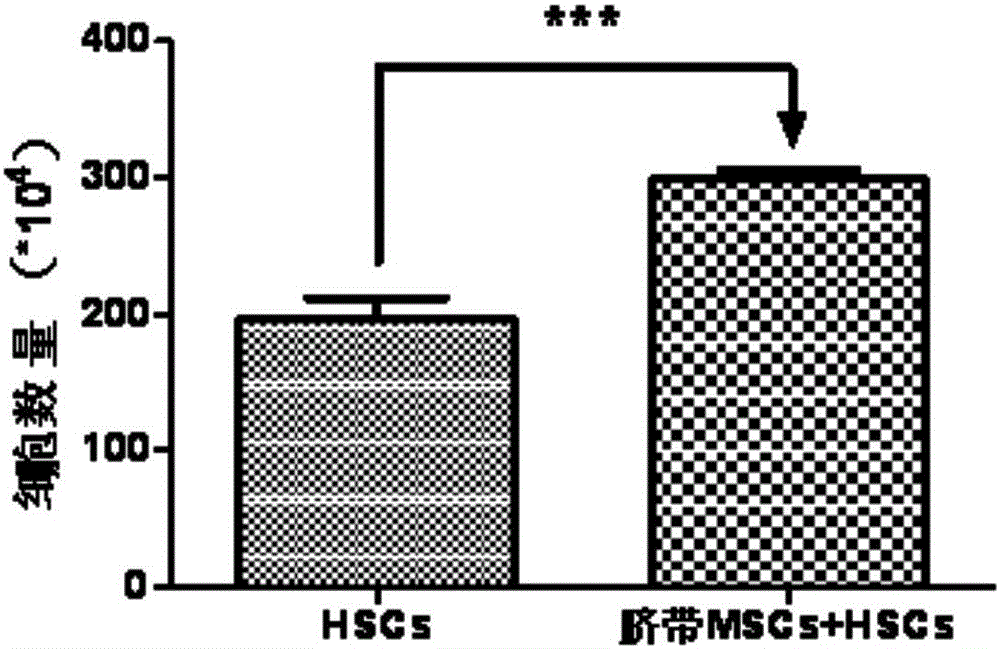 Purpose of umbilical cord mesenchymal stem cell exosome