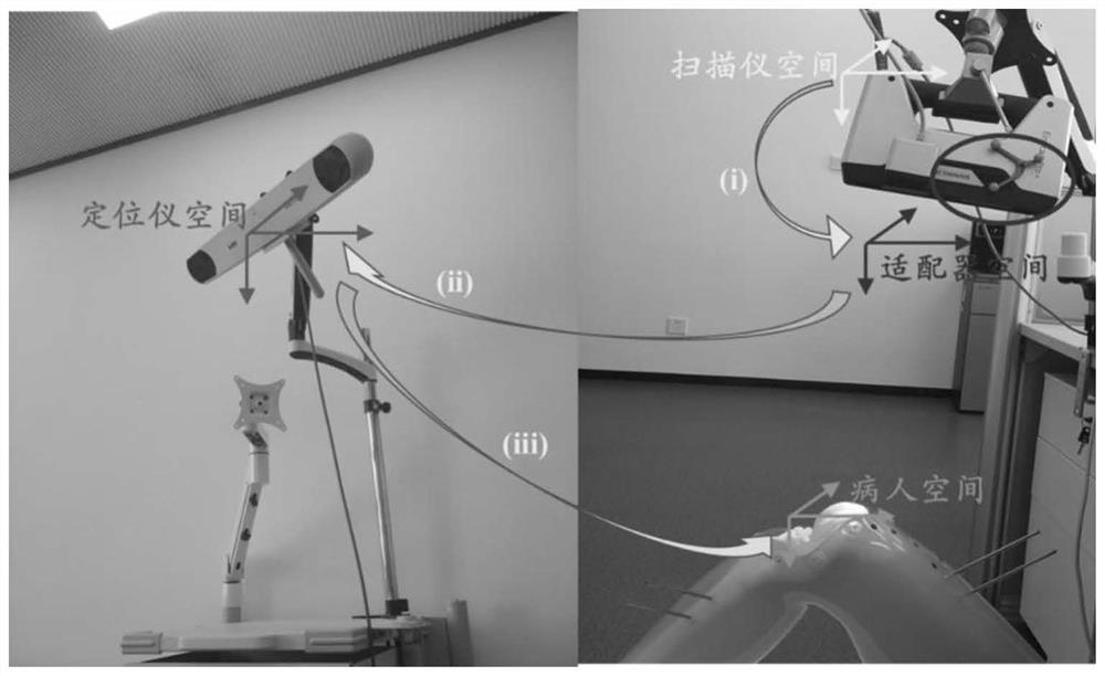 Knee joint replacement space registration system based on multi-modal fusion and point cloud registration