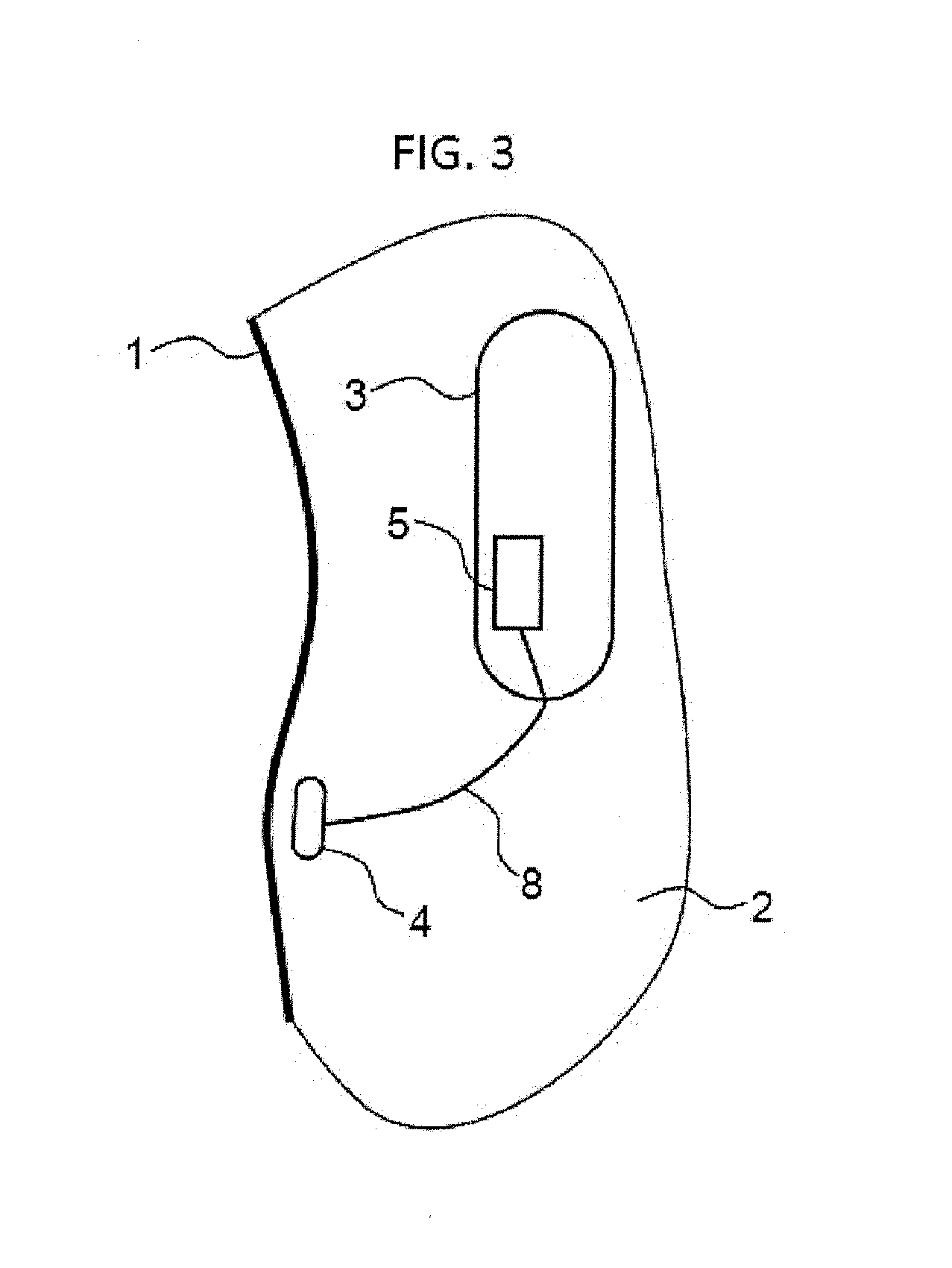 System for controlling an implantable device on the basis of commands issued by a user