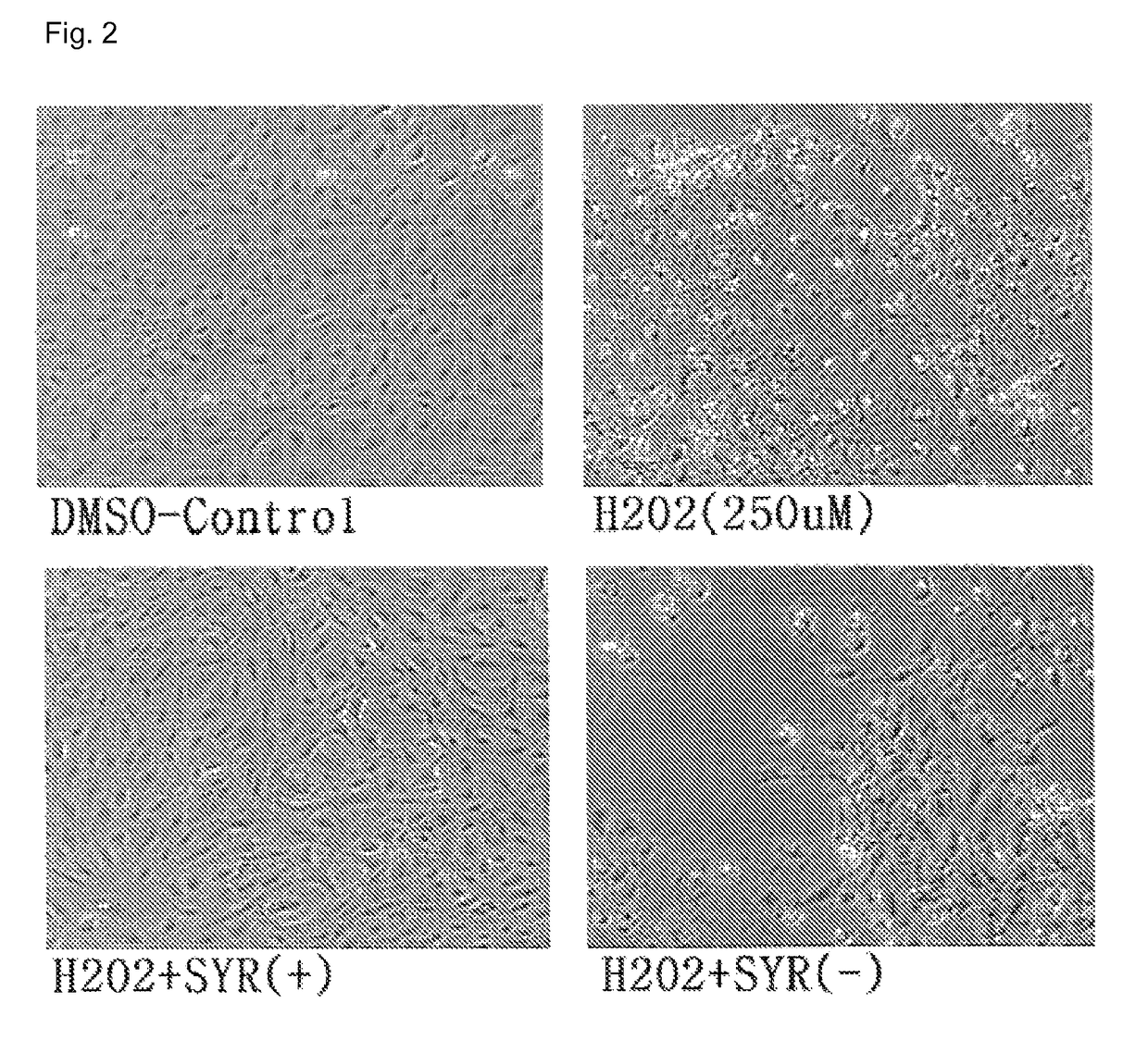 Composition for preventing or treating heart disease