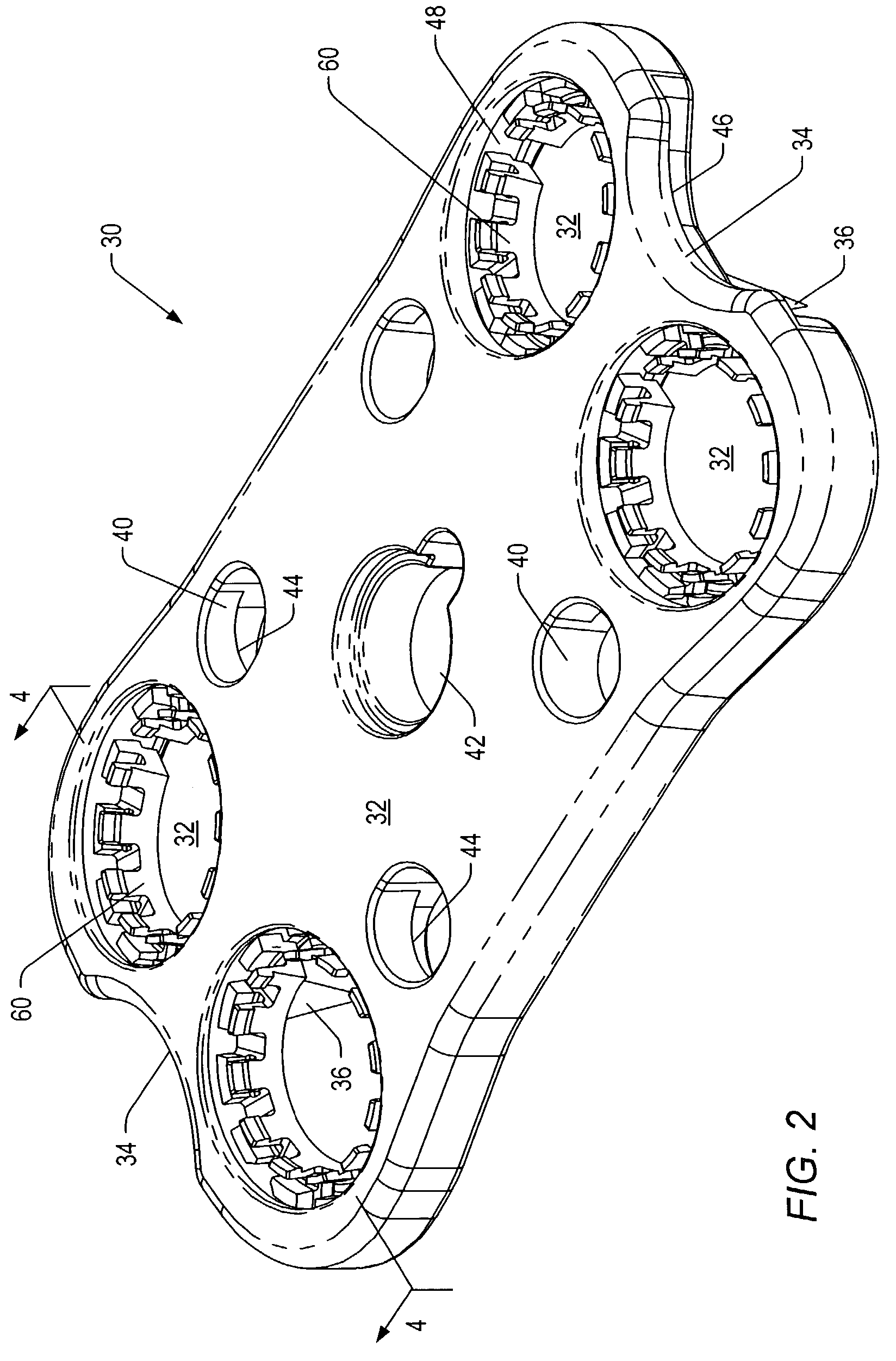 Spinal plate extender system and method