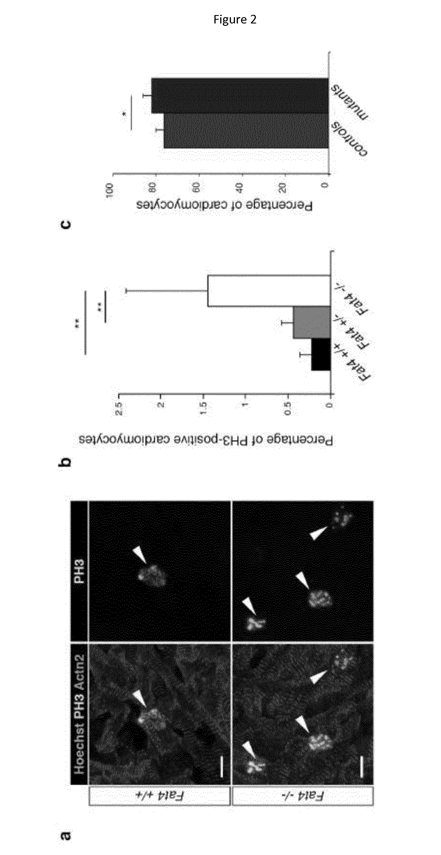 Treatment of cardiac diseases with modulators of the hippo pathway