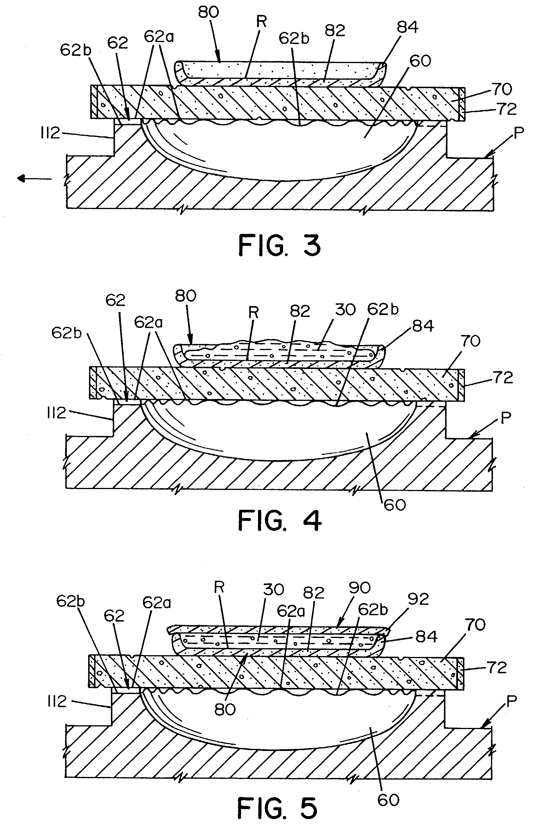 Method and apparatus for making commercial crustless sandwiches and the crustless sandwich made thereby