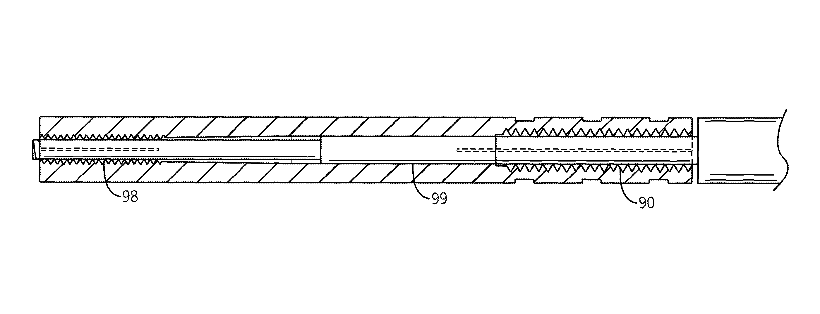 Taper-locking ferrule