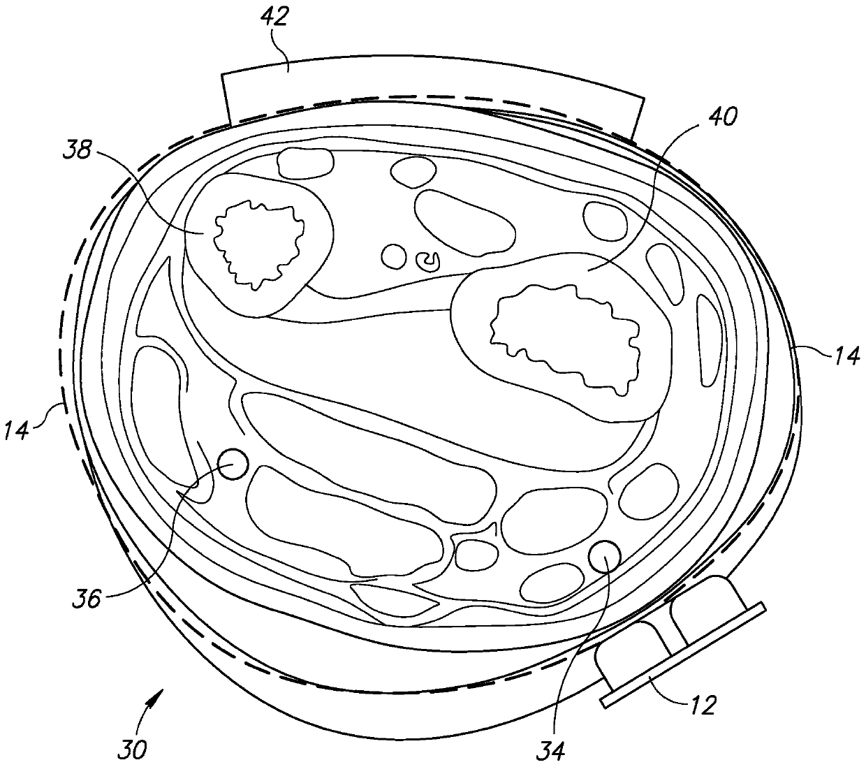 Method and system for ventricular assistive device adjustment using a wearable device