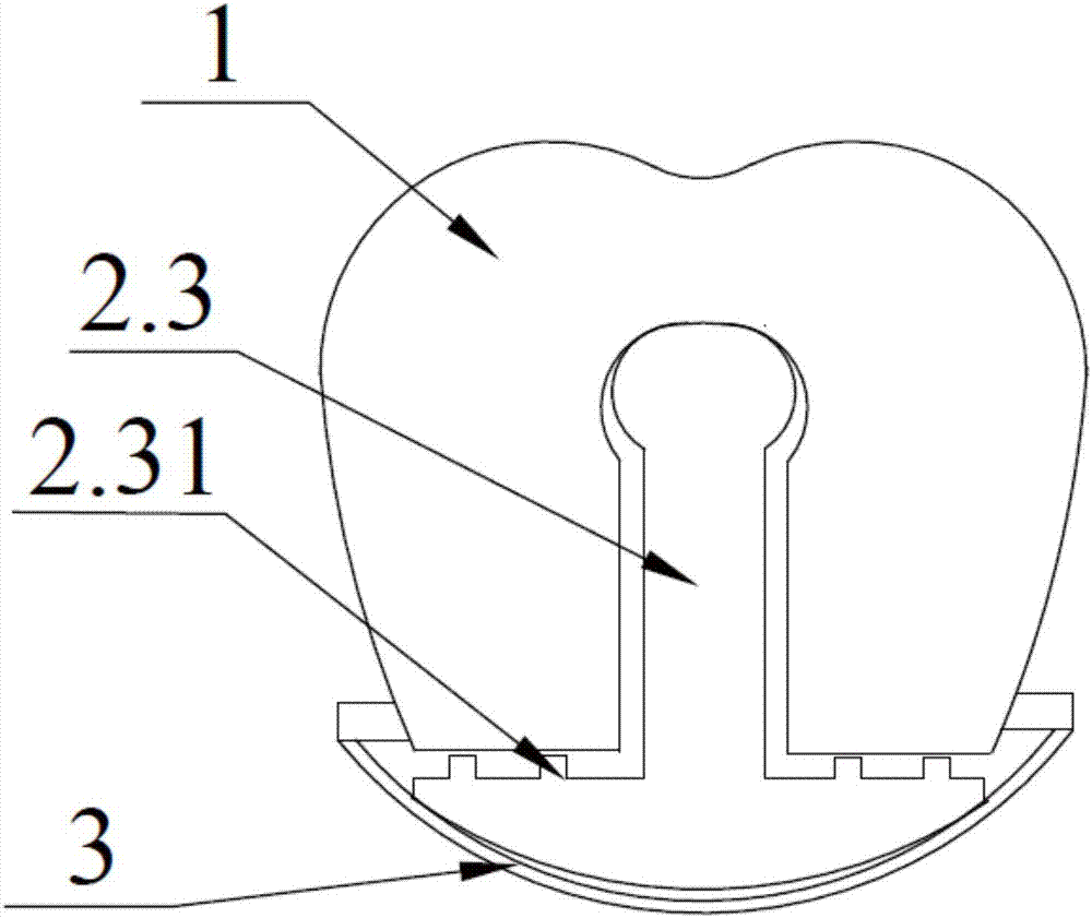 Complete denture movable flap and assembling method thereof