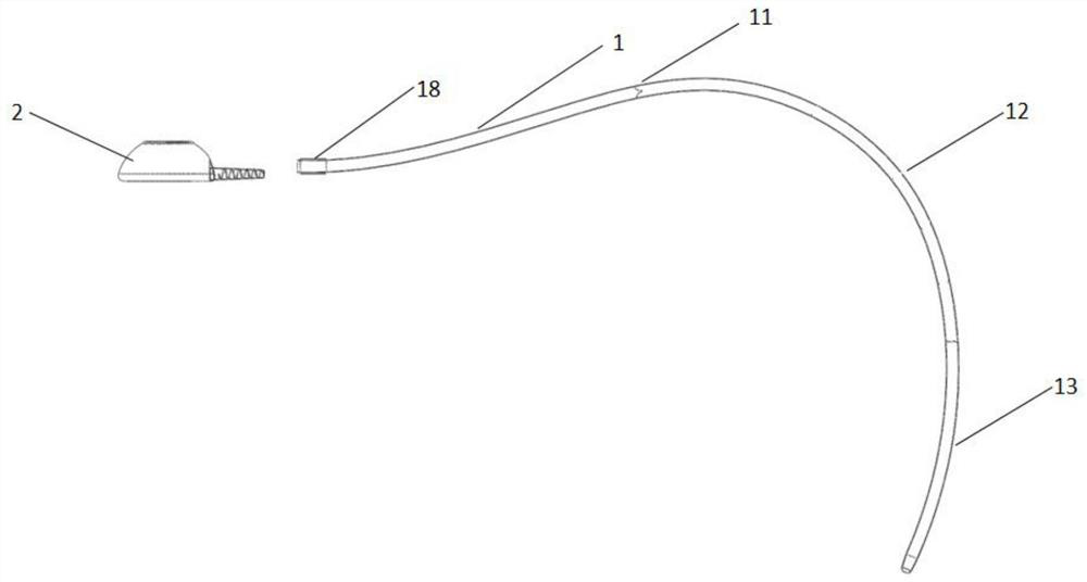 A subcutaneously implanted biliary drainage tube