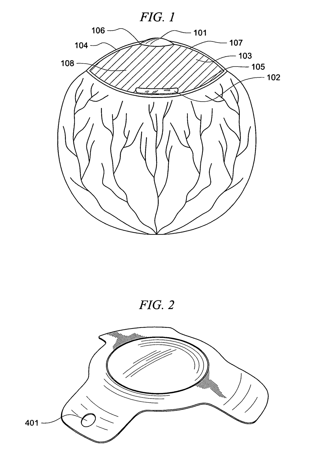 Multilens intraocular lens system with injectable accommodation material
