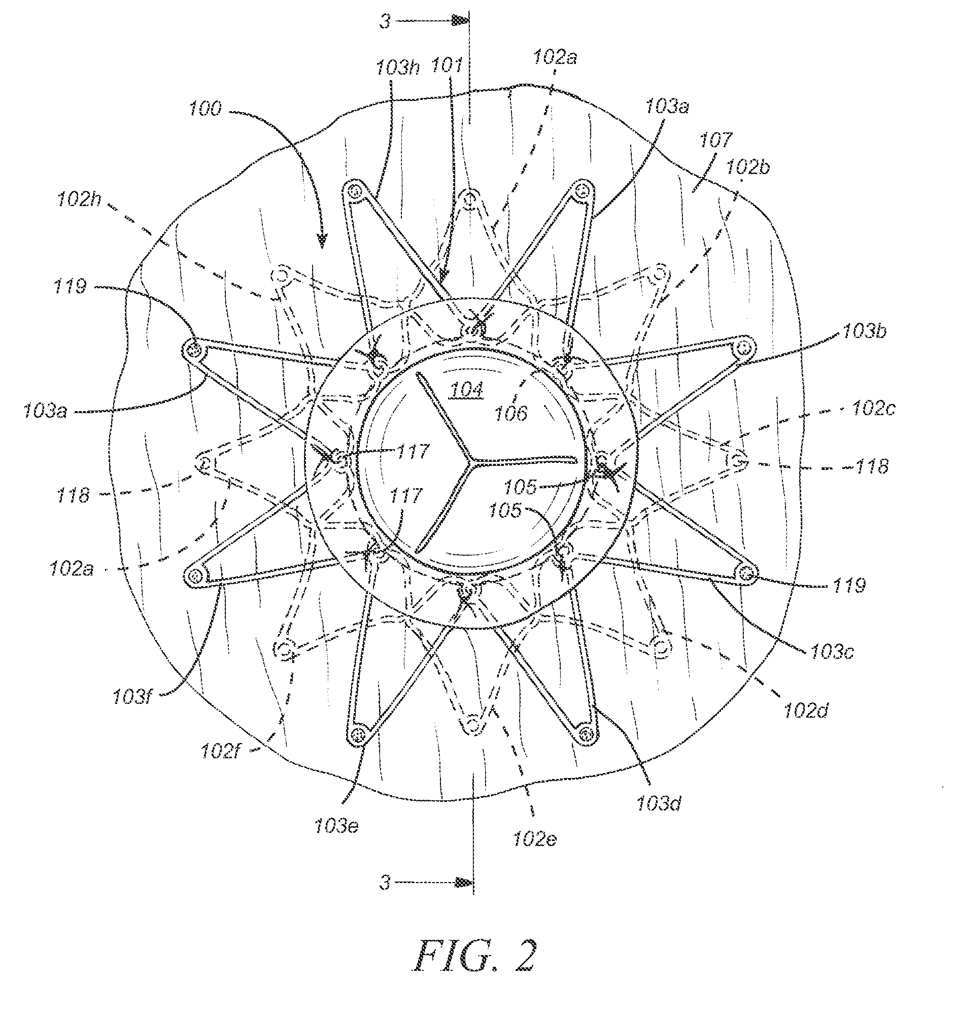 Methods for deploying a prosthesis