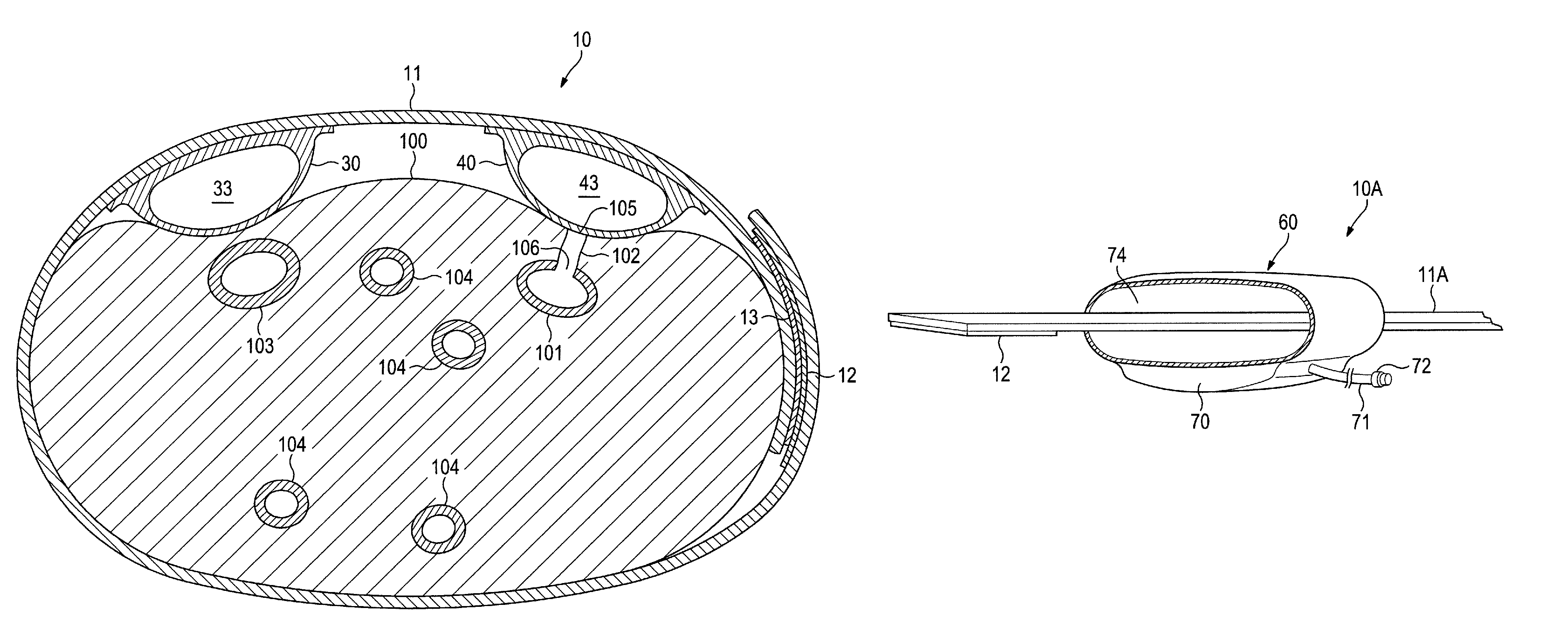 Apparatus and method of use for an adjustable radial and ulnar compression wristband